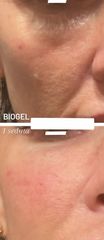 Filler - Dott. Diego Dedola