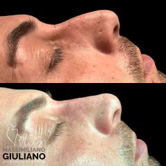 Dr Giuliano Rinofiller